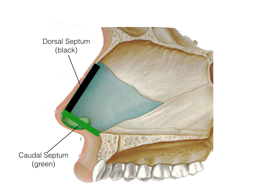 Caudal dorsal septum caudal-dorsal-septum